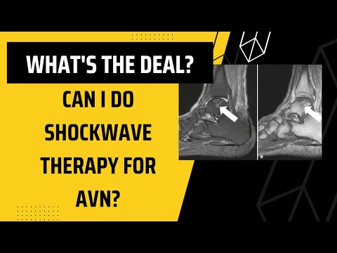 What's the deal? - Can I do Shockwave Therapy for AVN?