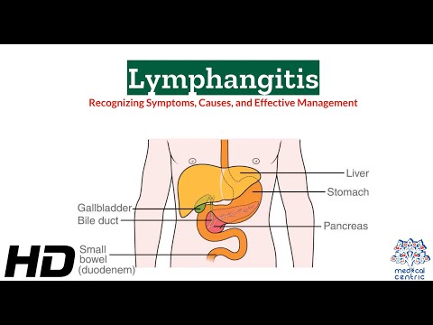 Effects of Cannabis on your body