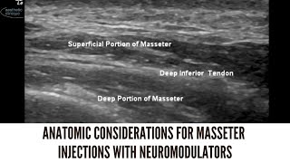 Anatomic Considerations For Masseter Injections With Neuromodulators