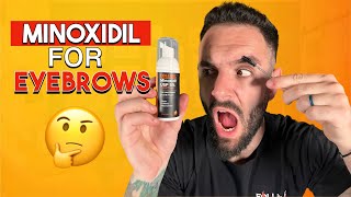 Can Minoxidil Help YOU Grow Your Eyebrows?!