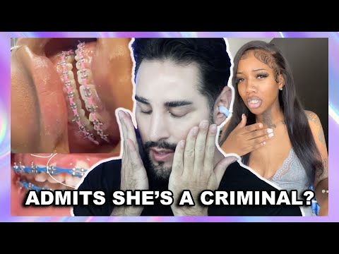 Unlicensed TikToker admits to illegal dentistry on camera