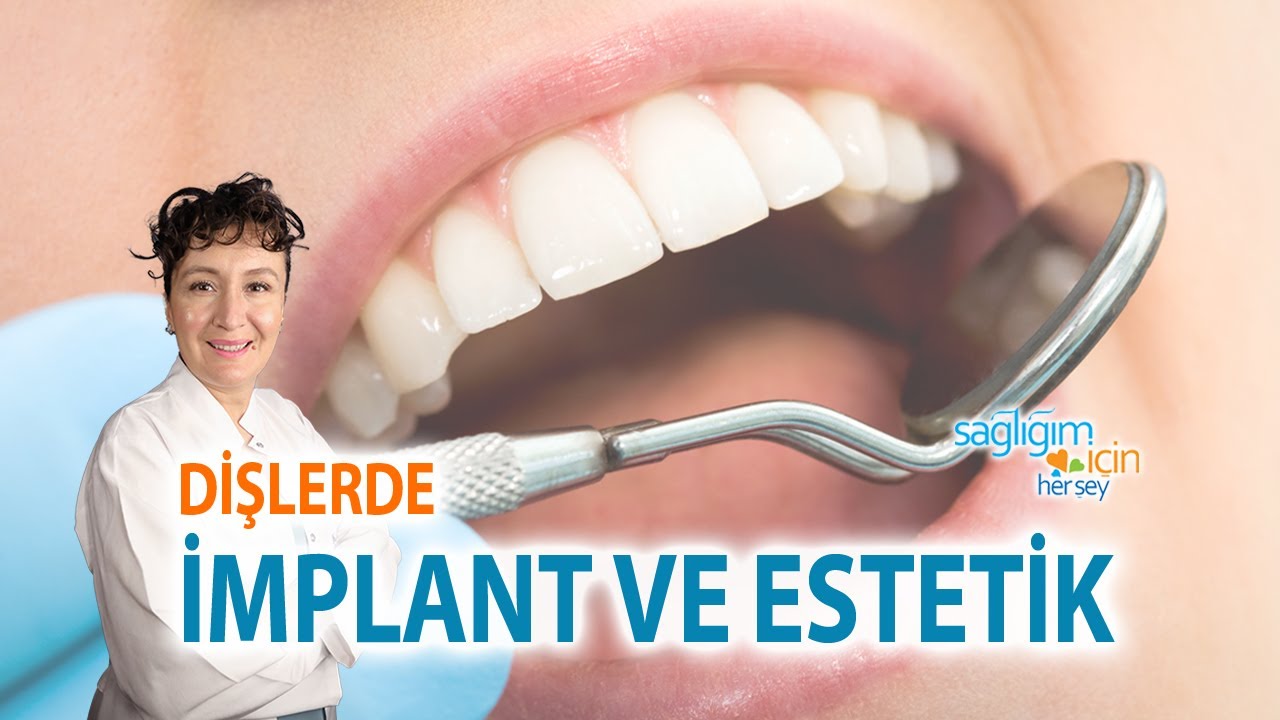 Dişlerde İmplant ve Estetik