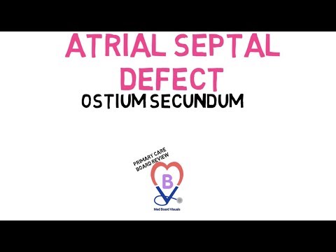 Atrial Septal Defect (Ostium Secundum)
