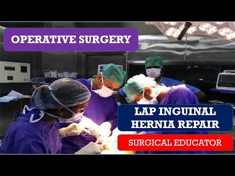 LAPAROSCOPIC INGUINAL HERNIA REPAIR-- STEP BY STEP  OPERATIVE SURGERY