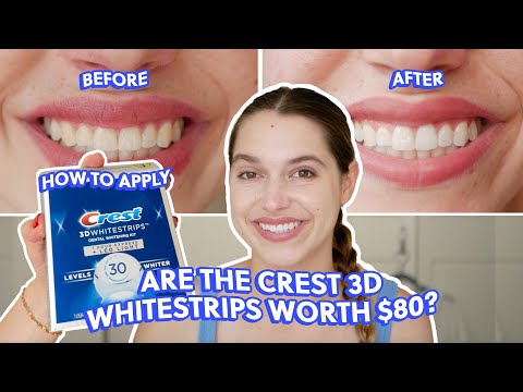 I Tried the Crest 3D Whitestrips With LED Light… Here’s the Before & After | Take My Money