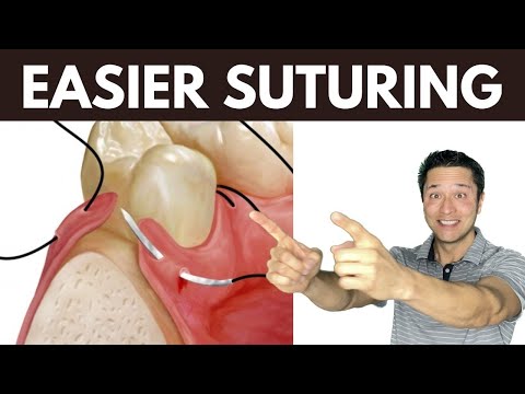 Easier Suturing - Tricks By Periodontist