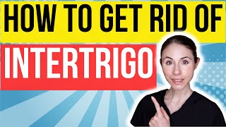 How To Get Rid Of Intertrigo FAST | Dermatologist Tips