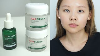 Dr. G R.E.D Blemish Clear Soothing Active Essence & Cream Review | Lululand