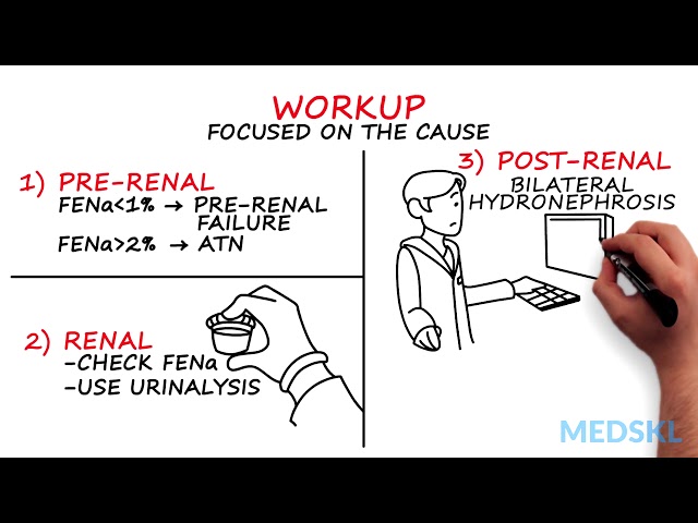 Video Aussprache von hydronephrosis in Englisch