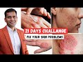 21 Days Challenge Cure Your All Skin Problems Dr Vivek Joshi