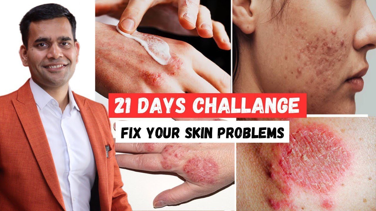 21 Days Challenge | Cure Your All Skin Problems  - Dr. Vivek Joshi