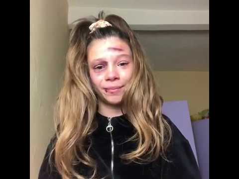 Chi ti ama non ti uccide.!❤️ MONOLOGO sulla violenza sulle donne.!🥰