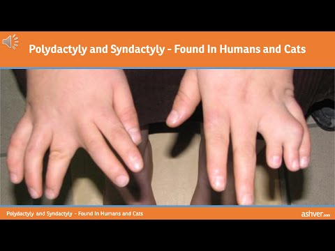 Polydactyly and Syndactyly - Found In Humans and Cats