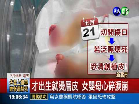 婦產科電毯燙女嬰 母淚崩痛批