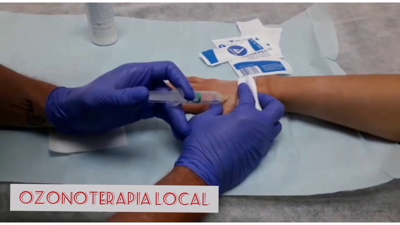 Ramiro Diego Abran-112