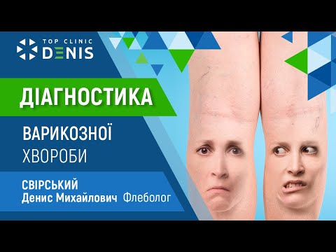 Диагностика варикозной болезни