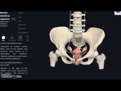 Ovarian cyst -- can it impact pain in hip/leg/lumbar?