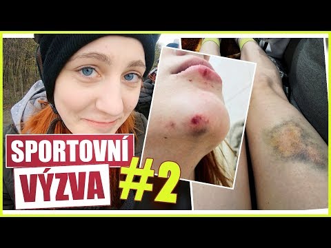 Tak jsem se rozsekala na kole... | 2. DÍL / NATYLA