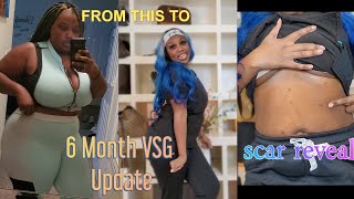 6 MONTH VSG UPDATE 《SCAR REVEAL》WHAT HAS REALLY BEEN GOING ON