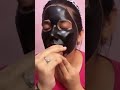Charcoal Peel Off Mask Remove Blackhead Whiteheads Results Awesome Short Youtubeshort