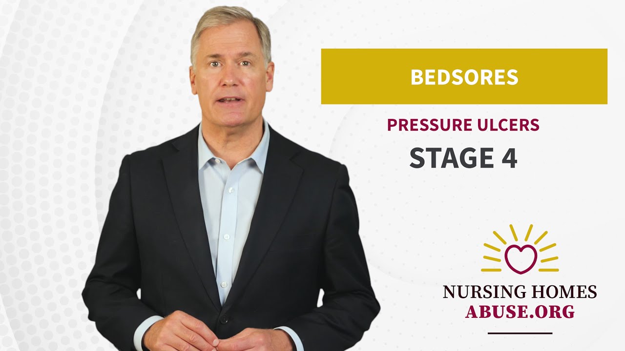Stage 4 Bed sores In Nursing Homes