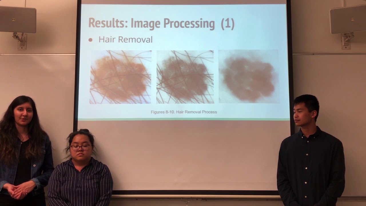 Machine Learning for Melanoma Detection