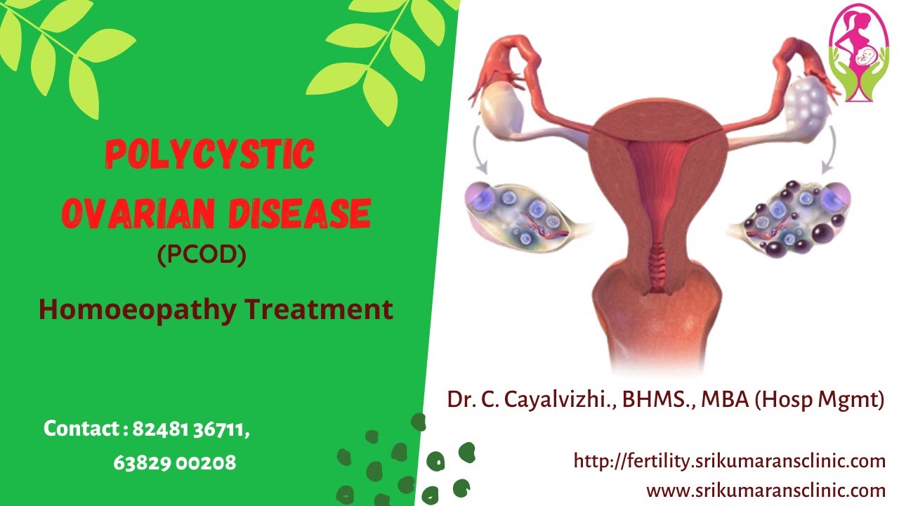 PCOD & Homoeopathy English Version