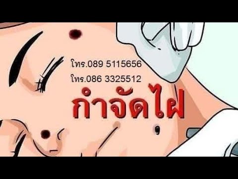 ดาวเพิ่มขึ้นหน้าอกในสิ่งที่คลินิก ผู้หญิงที่เป็นผู้ใหญ่ที่มีหน้าอกขนาดเล็ก