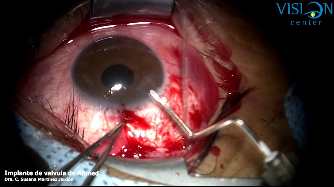 Roberto Ivan Delgadillo Garcia-22