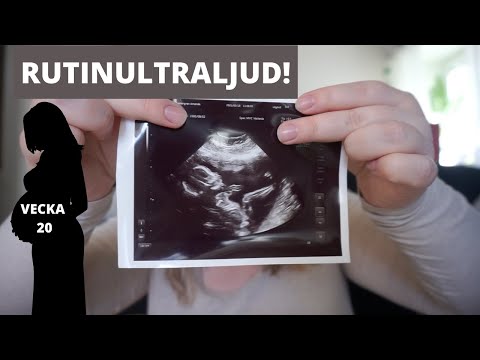 ULTRALJUD | Gravid vecka 20