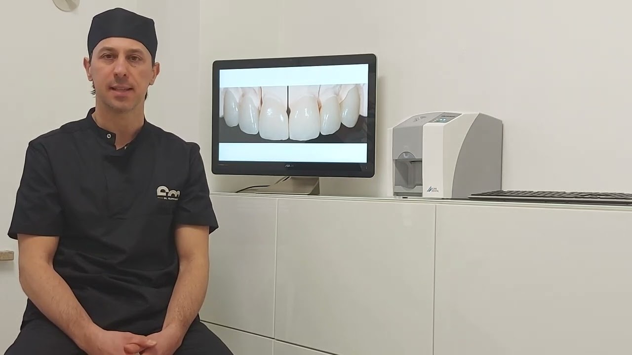 Il mock up vedi il risultato in anteprima