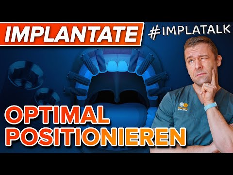 Richtige Positionierung von Zahnimplantaten - So hält dein Zahnersatz!