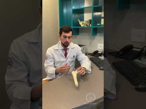 Thumbnail do vídeo Infiltração Bursite