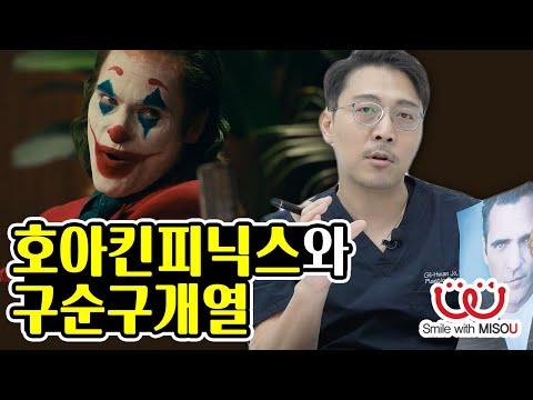 Logo of هل يعاني خواكين فينيكس، بطل فيلم "جوكر"، من شقّ الشفة والحنك؟ - مقابلة مع مدير عيادة ميسو لجراحة التجميل