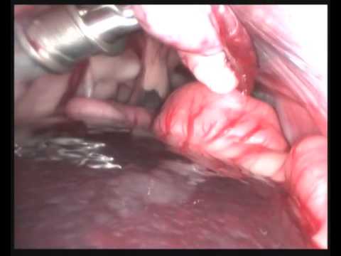 Film come per eccitare uno sguardo donna Forte eccitazione per azione veloce delle donne in farmacia