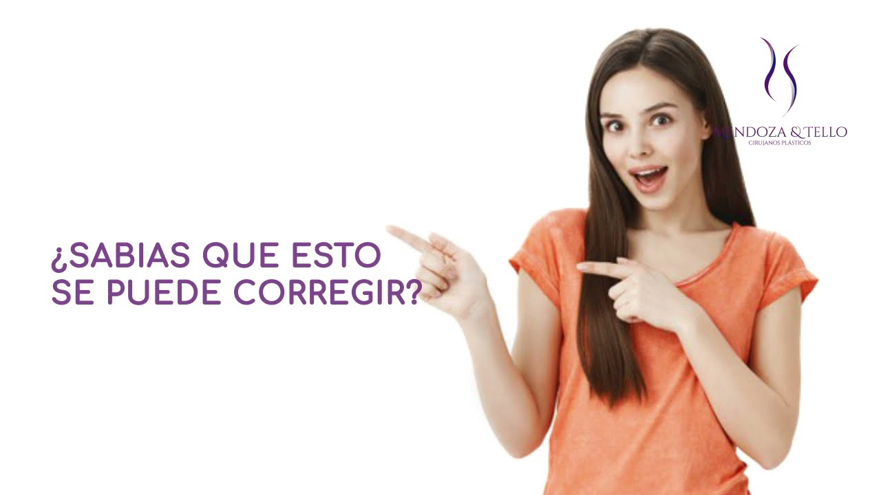 Alexander Mendoza-82