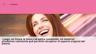 ð       Â¿Se puede comer despues de un empaste