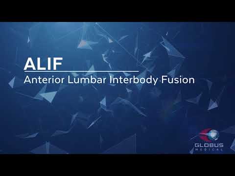 Anterior Lumbar Interbody Fusion (ALIF) - Patient Animation