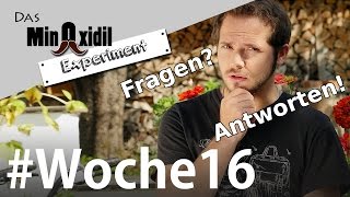 Das Minoxidil Experiment #Woche16 Das musst du wissen! Fragen und Antworten