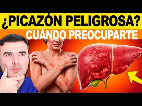 Itching in these areas = 99% cancer! If you suffer from this itching, watch this video immediately!