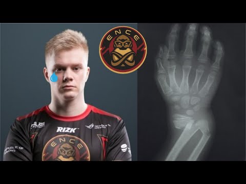 Not even Aerial from ENCE can stop my flicks