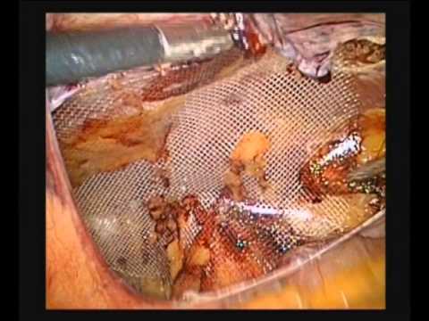 Wasserstoffperoxid aus dem Ellbogen Wunden an den Gelenken bei Hunden