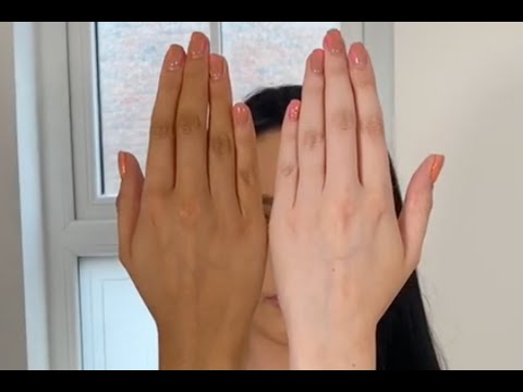 Hand Whitening | Hand Tan Laser Treatment | Sparsh Skin, Hair & Laser | Dr. Sunny Rajput