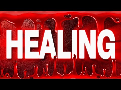 Receive Healing Today! Powerful Blood of Jesus Prayer against Sickness & Pain