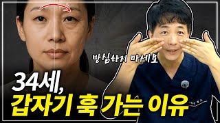 시술❌ 이걸 알아야 노화 막습니다 | 무너지는 얼굴 라인의 시기와 예방법