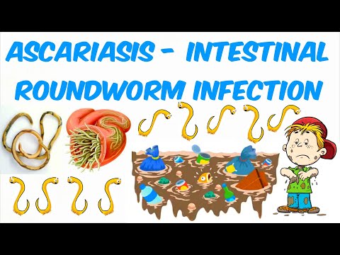Pinworms gyermekekben milyen gyógyszerek