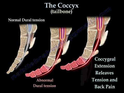 Coccydynia , coccyx pain  coccyx pain causes, diagnosis and treatment