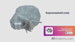 Temporal Bone   Supramastoid crest