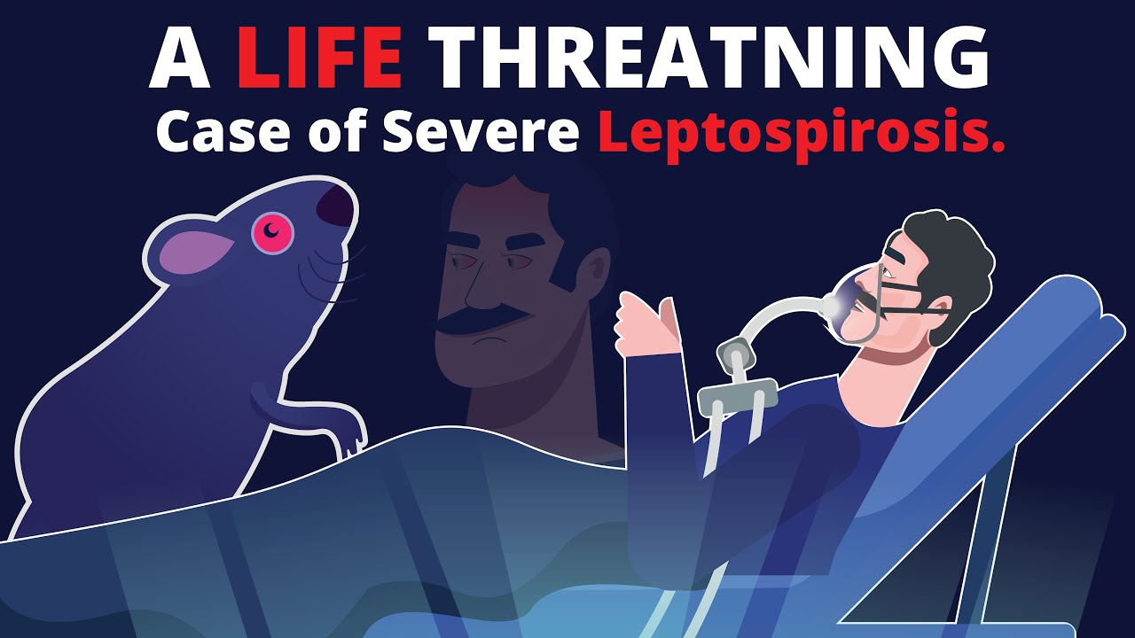 What is Leptospirosis? How does it cause Organ Failure? & How to treat?