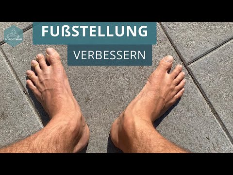 Füße zeigen nach außen: Fußstellung verbessern